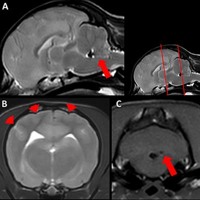 Case report: Lympho-histiocytic meningoencephalitis with central nervous system vasculitis of unknown origin in three dogs